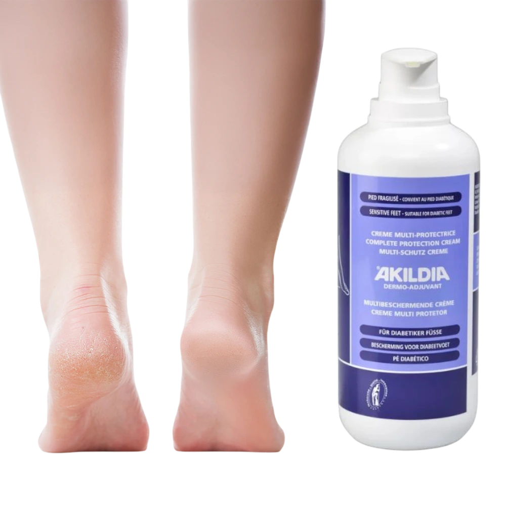 Akildia PRO Ochranný krém pro diabetiky 500 ml