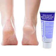 Ochranný krém na nohy pro diabetiky, Akildia - 75 ml