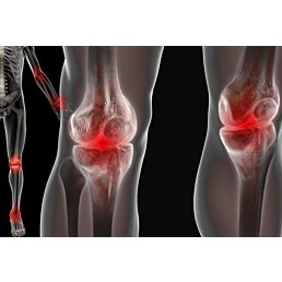 KolagénFit Senior – doplněk výživy pro podporu kloubů a kostí - Náhled