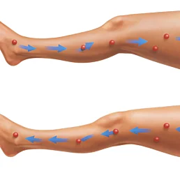 Presoterapie – lymfodrenážní masážní přístroj na nohy (domácí použití) - Náhled