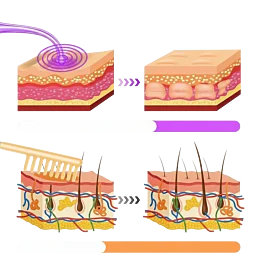 Kosmetický ozonizér – 6dílná sada na elektroterapii s hřebínkovou elektrodou - Náhled