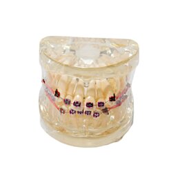 Model chrupu, zubních implantátů se zubním strojkem, transparentní