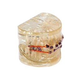 Model chrupu, zubních implantátů se zubním strojkem, transparentní - Náhled