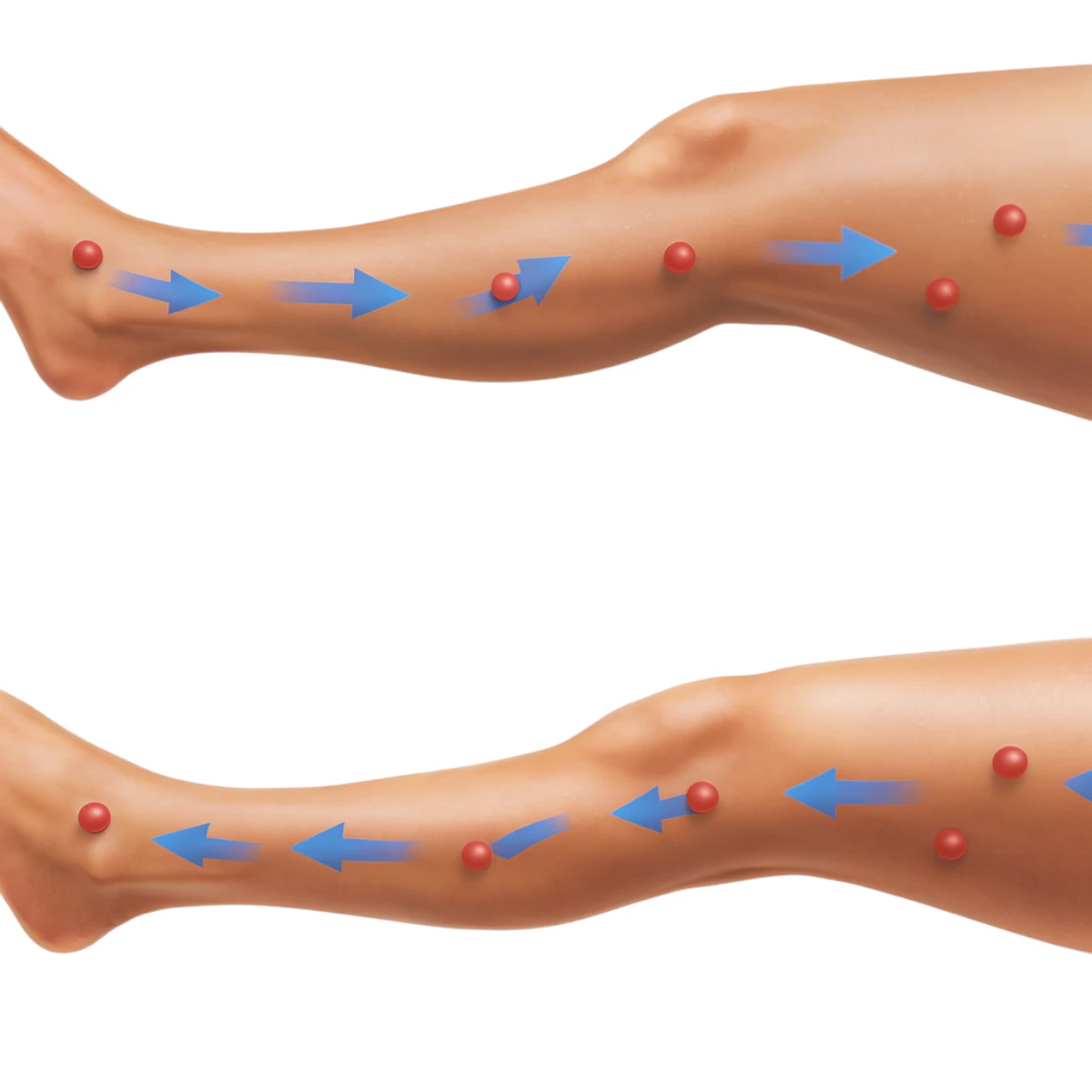 Lymfodrenážní přístroj – použití na stehna a lýtka