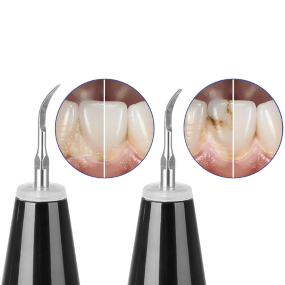 Nástavce a příslušenství k ultrazvukovému čističi zubního kamene