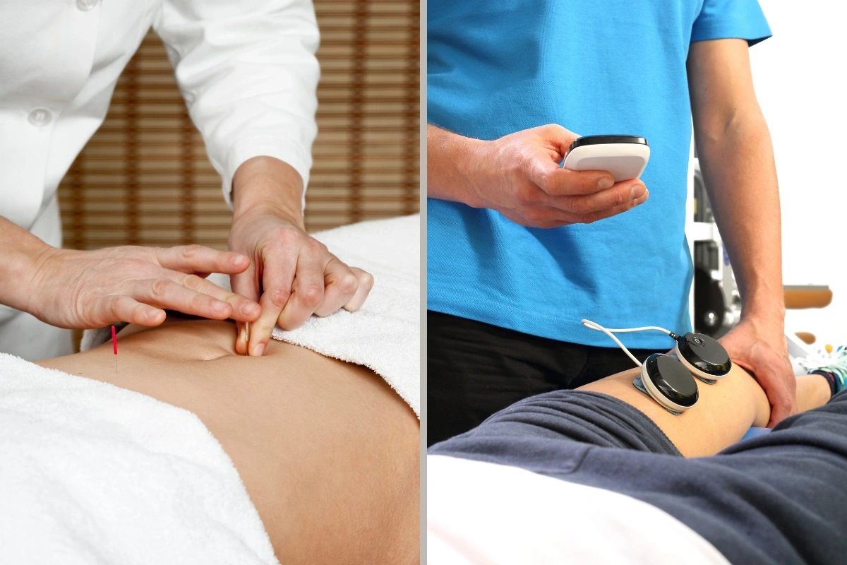 Vľavo ošetrovateľ aplikujúci akupunktúrne ihly na brucho pacienta, vpravo ležiaci pacient s elektródami pripojenými na stehne.