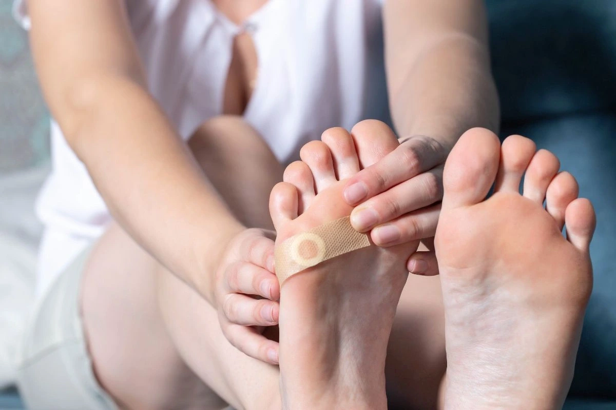 Žena si lepí ochrannou náplast na bradavici na chodidle.